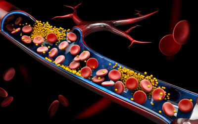 What is Cholesterol and How Does Too Much of It Affect Your Health?