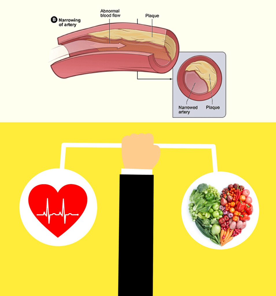 Reversing Heart Disease Naturally