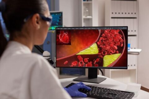 Vascular Surgery